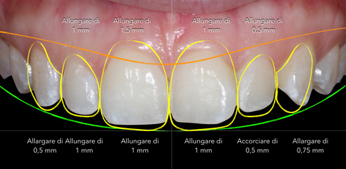 Studio Dentistico Gerboni Digital Smile Design 01 new