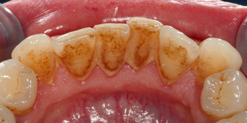 Studio Dentistico Gerboni Igiene Orale e Prevenzione 01