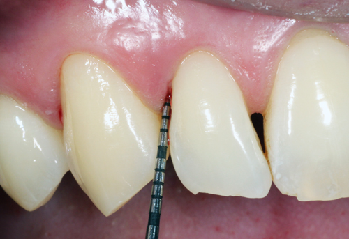 Studio Dentistico Gerboni Parodontologia 01