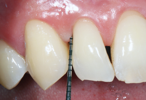 Studio Dentistico Gerboni Parodontologia 02
