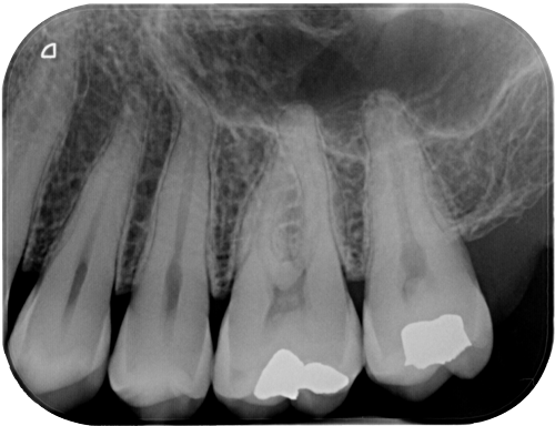 Studio Dentistico Gerboni Radiologia Endorale