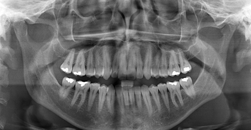 Studio Dentistico Gerboni Radiologia Ortopanoramica